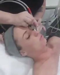 Our Deluxe Microdermabrasion 

Cleanse, Tone, Mic…