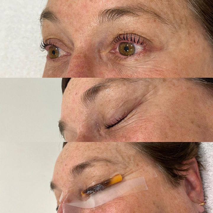 During & After Lash Lift ️

Our Beautiful Cli…